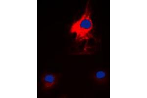 Immunofluorescent analysis of HARS staining in K562 cells.