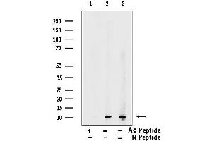 Western blot analysis of lysates from rat liver tissue, using Acetyl-Histone H4 (Lys5) Antibody.