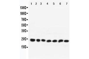 Western Blotting (WB) image for anti-RAB9A, Member RAS Oncogene Family (RAB9A) (AA 178-193), (C-Term) antibody (ABIN3042553) (RAB9A antibody  (C-Term))