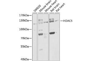 Western blot analysis of extracts of various cell lines, using HD antibody (ABIN6133742, ABIN6141675, ABIN6141678 and ABIN6213911) at 1:1000 dilution. (HDAC5 antibody  (AA 550-650))