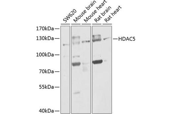 HDAC5 antibody  (AA 550-650)