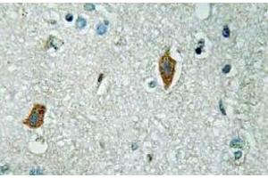 Immunohistochemistry (IHC) analyzes of PAI-2 antibody in paraffin-embedded human brain tissue. (SERPINB2 antibody)