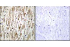 Immunohistochemistry analysis of paraffin-embedded human heart tissue, using LIMK2 Antibody. (LIMK2 antibody  (AA 461-510))