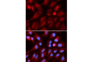 Immunofluorescence (IF) image for anti-Proteasome (Prosome, Macropain) Subunit, beta Type 2 (PSMB2) antibody (ABIN1876671) (PSMB2 antibody)