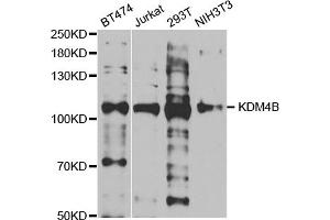 Western blot analysis of extracts of various cell lines, using KDM4B antibody (ABIN5973438) at 1/1000 dilution. (KDM4B antibody)