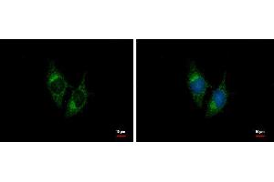 NPPB antibody