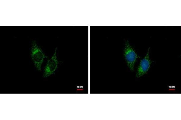 NPPB antibody