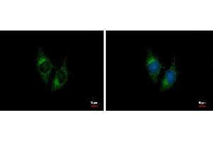 ICC/IF Image BNP antibody [N1C3] detects BNP protein at cytoplasm by immunofluorescent analysis. (NPPB antibody)