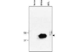 Image no. 1 for anti-Ring Finger Protein 34 (RNF34) (AA 1-373), (N-Term) antibody (ABIN401035)