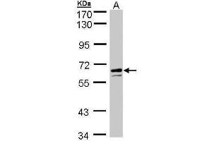 WB Image Sample (30 ug of whole cell lysate) A: HeLa S3 , 7. (Glucose-6-Phosphate Dehydrogenase antibody)