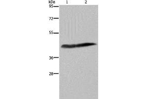 Western Blot analysis of Human placenta tissue and HepG2 cell using CD116 Polyclonal Antibody at dilution of 1:250 (CSF2RA antibody)