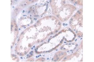 Detection of CLEC4C in Human Kidney Tissue using Polyclonal Antibody to C-Type Lectin Domain Family 4, Member C (CLEC4C) (CLEC4C antibody  (AA 5-152))