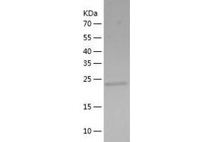 Western Blotting (WB) image for Suppressor of IKBKE 1 (SIKE1) (AA 1-207) protein (His tag) (ABIN7288576) (SIKE1 Protein (AA 1-207) (His tag))