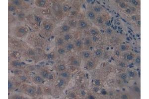 CS antibody  (AA 103-394)