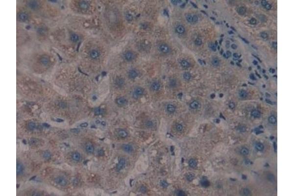 CS antibody  (AA 103-394)