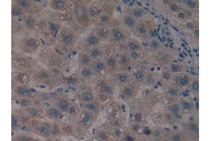 Detection of CS in Human Liver Tissue using Polyclonal Antibody to Citrate Synthase (CS)