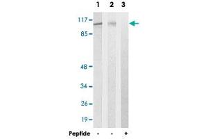 Western blot analysis of extracts from 293 cells (Lane 2) and HUVEC cells (Lane 1 and lane 3), using EFTUD2 polyclonal antibody .