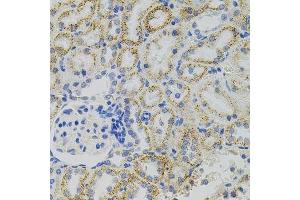 Immunohistochemistry of paraffin-embedded rat kidney using EPO antibody. (EPO antibody)