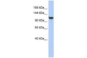 TMEM63C antibody used at 1 ug/ml to detect target protein. (TMEM63C antibody  (Middle Region))