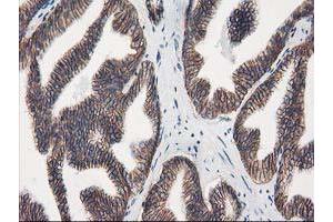 Image no. 1 for anti-Vascular Cell Adhesion Molecule 1 (VCAM1) antibody (ABIN1497155) (VCAM1 antibody)