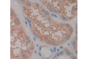 Immunohistochemistry (IHC) image for anti-Chemokine (C-C Motif) Ligand 17 (CCL17) (AA 24-94) antibody (ABIN1174779)