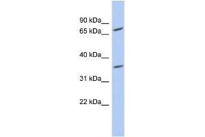 WB Suggested Anti-PPAPDC2 Antibody Titration: 0.