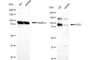 Western blotting analysis using GYS1 antibody (ABIN7798775).