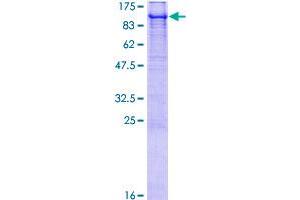 ube3a Protein (AA 1-875) (GST tag)