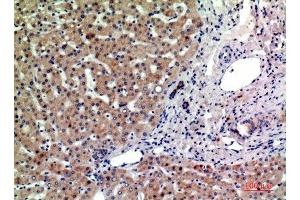 Immunohistochemical analysis of paraffin-embedded human-liver, antibody was diluted at 1:200 (PTGFRN antibody  (Internal Region))