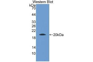 Detection of Recombinant LPO, Mouse using Polyclonal Antibody to Lactoperoxidase (LPO) (LPO antibody  (AA 305-498))