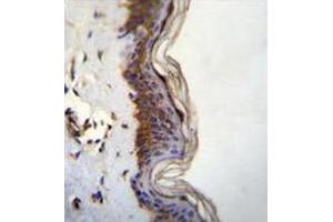 Immunohistochemistry analysis in human skin tissue (formalin-fixed, paraffin-embedded) using FHAD1 Antibody (C-term), followed by peroxidase conjugation of the secondary antibody and DAB staining. (FHAD1 antibody  (C-Term))