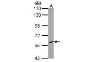 Image no. 1 for anti-Cytochrome P450, Family 46, Subfamily A, Polypeptide 1 (CYP46A1) (AA 15-315) antibody (ABIN1497738)