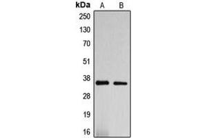 Western blot analysis of DNAJC17 expression in HepG2 (A), SP2/0 (B) whole cell lysates.