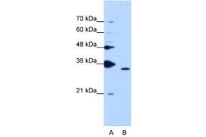 WB Suggested Anti-PPIE  Antibody Titration: 1. (PPIE antibody  (Middle Region))