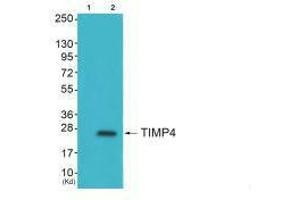 Western blot analysis of extracts from HepG2 cells (Lane 2), using TIMP4 antiobdy.