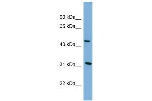 Western Blotting (WB) image for anti-serpin Peptidase Inhibitor, Clade I (Pancpin), Member 2 (SERPINI2) (Middle Region) antibody (ABIN2786839)