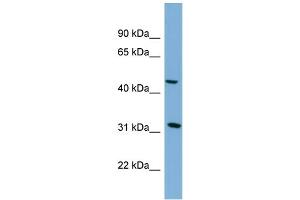 WB Suggested Anti-SERPINI2  Antibody Titration: 0. (SERPINI2 antibody  (Middle Region))
