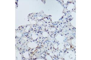 Immunohistochemistry of paraffin-embedded mouse lung using DDB1 Rabbit pAb (ABIN1679509, ABIN5664466, ABIN5664468 and ABIN6220382) at dilution of 1:350 (40x lens). (DDB1 antibody  (C-Term))