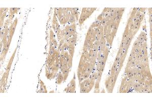 Immunohistochemistry (IHC) image for anti-Cardiac Troponin T (cTnT) (AA 1-295) antibody (ABIN7428809)