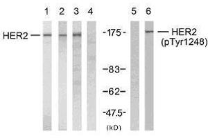 Western blot analysis using HER2 (Ab-1248) antibody (E021072, Line 1, 2, 3 and 4) and HER2 (phospho-Tyr1248) antibody (E011079, Line 5 and 6). (ErbB2/Her2 antibody  (pTyr1248))