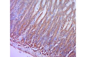 Paraformaldehyde-fixed, paraffin embedded Rat stomach, Antigen retrieval by boiling in sodium citrate buffer (pH6. (CCR2 antibody  (AA 301-373))