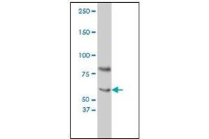 Western Blotting (WB) image for anti-Cryptochrome 1 (Photolyase-Like) (CRY1) antibody (ABIN781975) (CRY1 antibody)