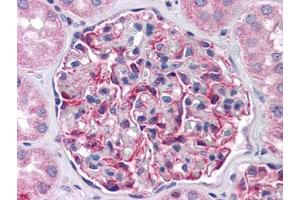Human Kidney: Formalin-Fixed, Paraffin-Embedded (FFPE) (FRMPD4 antibody)