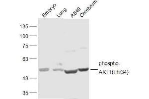 Lane 1: Mouse Embryo lysates Lane 2: Mouse Lung lysates Lane 3: A549 lysates Lane 4: Mouse Cerebrum lysates probed with AKT1(Thr34) Polyclonal Antibody, Unconjugated  at 1:300 dilution and 4˚C overnight incubation. (AKT1 antibody  (pThr34))