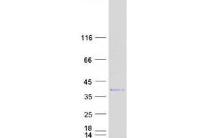 Western Blotting (WB) image for Inhibitor of Growth Family, Member 2 (ING2) protein (Myc-DYKDDDDK Tag) (ABIN2723447)