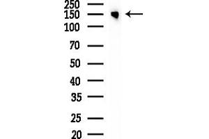 Western blot analysis of lysates from LoVo cells(heat-shock,45 min treatment), using Phospho-HER2/Erb (Tyr1112) Antibody at 1/1000 dilution.