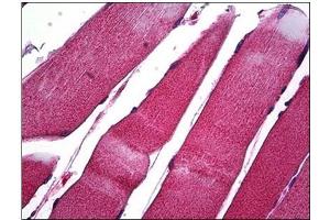 Human Skeletal Muscle: Formalin-Fixed, Paraffin-Embedded (FFPE) (MMP1 antibody  (C-Term))
