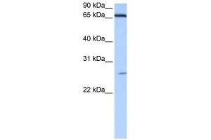 DKFZp686E2433 antibody used at 0. (ZNF879 antibody  (N-Term))
