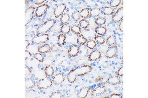 Immunohistochemistry of paraffin-embedded Mouse kidney using EPN1 Rabbit pAb (ABIN7267000) at dilution of 1:100 (40x lens). (Epsin 1 antibody  (AA 130-180))