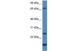 WB Suggested Anti-GSTM5 Antibody Titration:  0.